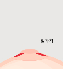 유관보존법