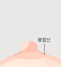 유관보존법