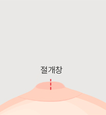 비유관보존법