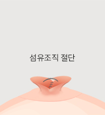 비유관보존법