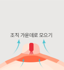 비유관보존법