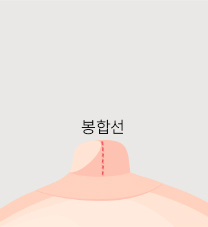 비유관보존법